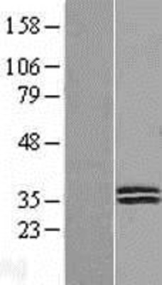 Western Blot: Deoxyribonuclease I like 1 Overexpression Lysate (Adult Normal) [NBL1-09962] Left-Empty vector transfected control cell lysate (HEK293 cell lysate); Right -Over-expression Lysate for Deoxyribonuclease I like 1.