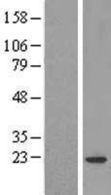 Western Blot: COPZ1 Overexpression Lysate (Adult Normal) [NBL1-09387] Left-Empty vector transfected control cell lysate (HEK293 cell lysate); Right -Over-expression Lysate for COPZ1.