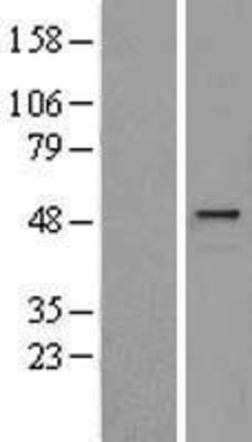 Western Blot: HYAL1 Overexpression Lysate (Adult Normal) [NBL1-11791] Left-Empty vector transfected control cell lysate (HEK293 cell lysate); Right -Over-expression Lysate for HYAL1.