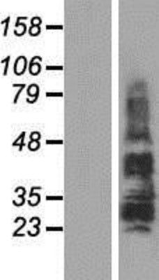 Western Blot: TSPAN18 Overexpression Lysate (Adult Normal) [NBP2-05736] Left-Empty vector transfected control cell lysate (HEK293 cell lysate); Right -Over-expression Lysate for TSPAN18.