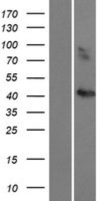 Western Blot: CCBE1 Overexpression Lysate (Adult Normal) [NBP2-05700] Left-Empty vector transfected control cell lysate (HEK293 cell lysate); Right -Over-expression Lysate for CCBE1.
