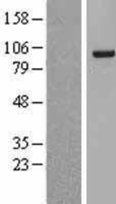 Western Blot: SF3A1 Overexpression Lysate (Adult Normal) [NBL1-15874] Left-Empty vector transfected control cell lysate (HEK293 cell lysate); Right -Over-expression Lysate for SF3A1.