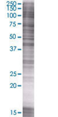 ARL6IP2 transfected lysate.