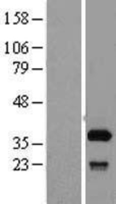 Western Blot: SFXN1 Overexpression Lysate (Adult Normal) [NBL1-15898] Left-Empty vector transfected control cell lysate (HEK293 cell lysate); Right -Over-expression Lysate for SFXN1.