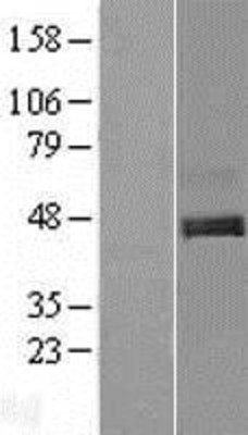 Western Blot: C1orf187 Overexpression Lysate (Adult Normal) [NBL1-08308] Left-Empty vector transfected control cell lysate (HEK293 cell lysate); Right -Over-expression Lysate for C1orf187.