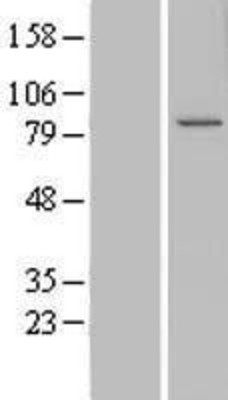 Western Blot: CCDC82 Overexpression Lysate (Adult Normal) [NBL1-08825] Left-Empty vector transfected control cell lysate (HEK293 cell lysate); Right -Over-expression Lysate for CCDC82.