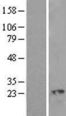 Western Blot: Ropporin 1-like Overexpression Lysate (Adult Normal) [NBL1-15476] Left-Empty vector transfected control cell lysate (HEK293 cell lysate); Right -Over-expression Lysate for Ropporin 1-like.