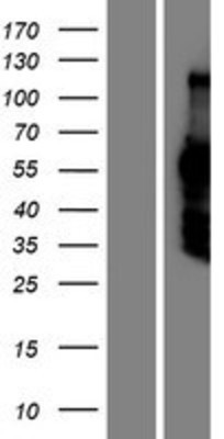 Western Blot: DACH2 Overexpression Lysate (Adult Normal) [NBP2-05817] Left-Empty vector transfected control cell lysate (HEK293 cell lysate); Right -Over-expression Lysate for DACH2.