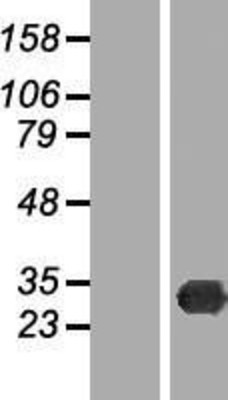 Western Blot: TREX2 Overexpression Lysate (Adult Normal) [NBP2-05769] Left-Empty vector transfected control cell lysate (HEK293 cell lysate); Right -Over-expression Lysate for TREX2.