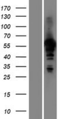 Western Blot: NYS48 Overexpression Lysate (Adult Normal) [NBP2-05878] Left-Empty vector transfected control cell lysate (HEK293 cell lysate); Right -Over-expression Lysate for NYS48.