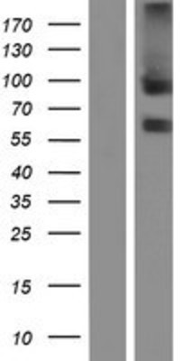 Western Blot: TEM8 Overexpression Lysate (Adult Normal) [NBL1-07554] Left-Empty vector transfected control cell lysate (HEK293 cell lysate); Right -Over-expression Lysate for TEM8.