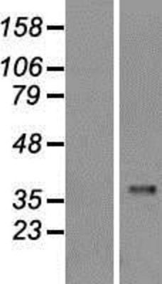 Western Blot: Caspase 1 Overexpression Lysate (Adult Normal) [NBL1-08706] Left-Empty vector transfected control cell lysate (HEK293 cell lysate); Right -Over-expression Lysate for Caspase 1.