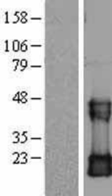 Western Blot: CDC42 Overexpression Lysate (Adult Normal) [NBL1-09004] Left-Empty vector transfected control cell lysate (HEK293 cell lysate); Right -Over-expression Lysate for CDC42.