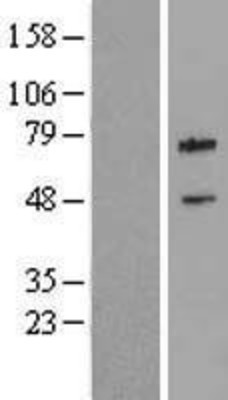 Western Blot: cIAP2 Overexpression Lysate (Adult Normal) [NBL1-07985] Left-Empty vector transfected control cell lysate (HEK293 cell lysate); Right -Over-expression Lysate for cIAP2.