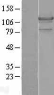 Western Blot: HSL Overexpression Lysate (Adult Normal) [NBL1-12548] Left-Empty vector transfected control cell lysate (HEK293 cell lysate); Right -Over-expression Lysate for HSL.