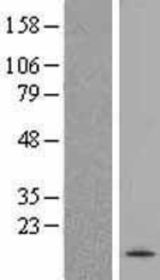 Western Blot: SPRN Overexpression Lysate (Adult Normal) [NBL1-16429] Left-Empty vector transfected control cell lysate (HEK293 cell lysate); Right -Over-expression Lysate for SPRN.
