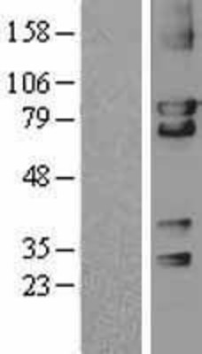 Western Blot: cGK2/PRKG2 Overexpression Lysate (Adult Normal) [NBL1-14783] Left-Empty vector transfected control cell lysate (HEK293 cell lysate); Right -Over-expression Lysate for cGK2/PRKG2.