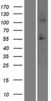 Western Blot: SRCRB4D Overexpression Lysate (Adult Normal) [NBP2-05760] Left-Empty vector transfected control cell lysate (HEK293 cell lysate); Right -Over-expression Lysate for SRCRB4D.
