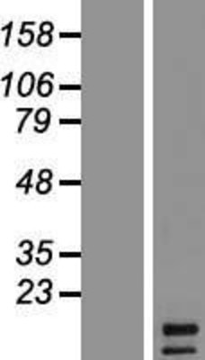 Western Blot: FGF5 Overexpression Lysate (Adult Normal) [NBP2-05915] Left-Empty vector transfected control cell lysate (HEK293 cell lysate); Right -Over-expression Lysate for FGF5.