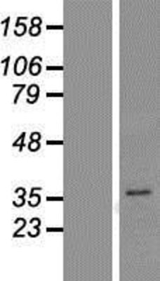 Western Blot: PGAP3 Overexpression Lysate (Adult Normal) [NBP2-05879] Left-Empty vector transfected control cell lysate (HEK293 cell lysate); Right -Over-expression Lysate for PGAP3.