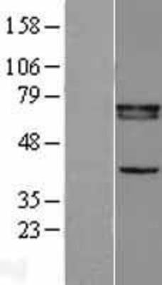 Western Blot: Retinoid X Receptor beta Overexpression Lysate (Adult Normal) [NBL1-15642] Left-Empty vector transfected control cell lysate (HEK293 cell lysate); Right -Over-expression Lysate for Retinoid X Receptor beta.