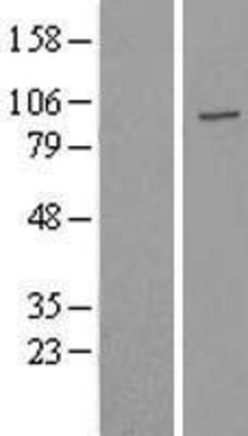 Western Blot: USP16 Overexpression Lysate (Adult Normal) [NBL1-17647] Left-Empty vector transfected control cell lysate (HEK293 cell lysate); Right -Over-expression Lysate for USP16.