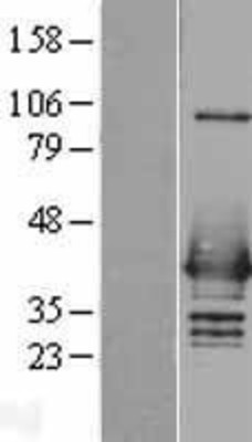 Western Blot: hnRNP C1 + C2 Overexpression Lysate (Adult Normal) [NBL1-11638] Left-Empty vector transfected control cell lysate (HEK293 cell lysate); Right -Over-expression Lysate for hnRNP C1 + C2.