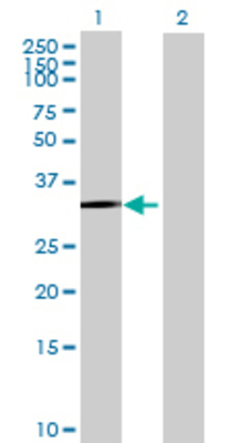 Lane 1: ROM1 transfected lysate (38.72 KDa) Lane 2: Non-transfected lysate.