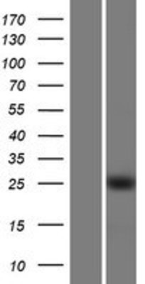 Western Blot: KLF16 Overexpression Lysate (Adult Normal) [NBP2-06101] Left-Empty vector transfected control cell lysate (HEK293 cell lysate); Right -Over-expression Lysate for KLF16.