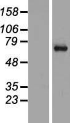 Western Blot: SYT16 Overexpression Lysate (Adult Normal) [NBP2-06104] Left-Empty vector transfected control cell lysate (HEK293 cell lysate); Right -Over-expression Lysate for SYT16.