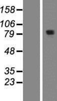 Western Blot: KIAA1841 Overexpression Lysate (Adult Normal) [NBP2-06011] Left-Empty vector transfected control cell lysate (HEK293 cell lysate); Right -Over-expression Lysate for KIAA1841.