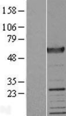 Western Blot: Dystrobrevin alpha Overexpression Lysate (Adult Normal) [NBP2-05939] Left-Empty vector transfected control cell lysate (HEK293 cell lysate); Right -Over-expression Lysate for Dystrobrevin alpha.