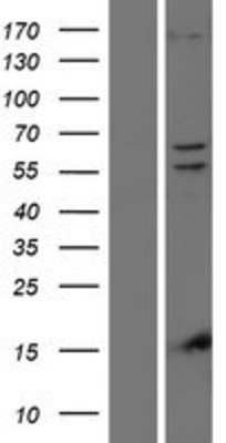 Western Blot: PINK1 Overexpression Lysate (Adult Normal) [NBP2-06032] Left-Empty vector transfected control cell lysate (HEK293 cell lysate); Right -Over-expression Lysate for PINK1.