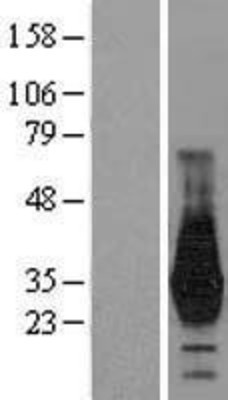 Western Blot: HOXD4 Overexpression Lysate (Adult Normal) [NBL1-11683] Left-Empty vector transfected control cell lysate (HEK293 cell lysate); Right -Over-expression Lysate for HOXD4.