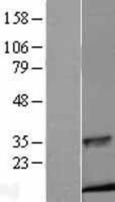 Western Blot: Insulin Overexpression Lysate (Adult Normal) [NBL1-12002] Left-Empty vector transfected control cell lysate (HEK293 cell lysate); Right -Over-expression Lysate for Insulin.