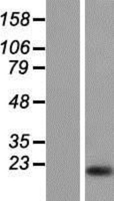Western Blot: Calpain 3 Overexpression Lysate (Adult Normal) [NBP2-05152] Left-Empty vector transfected control cell lysate (HEK293 cell lysate); Right -Over-expression Lysate for Calpain 3.