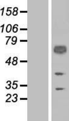 Western Blot: CD46 Overexpression Lysate (Adult Normal) [NBP2-05162] Left-Empty vector transfected control cell lysate (HEK293 cell lysate); Right -Over-expression Lysate for CD46.