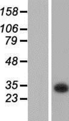 Western Blot: KCTD6 Overexpression Lysate (Adult Normal) [NBP2-05253] Left-Empty vector transfected control cell lysate (HEK293 cell lysate); Right -Over-expression Lysate for KCTD6.