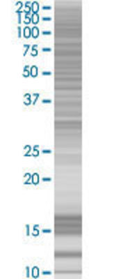 NET1 transfected lysate.