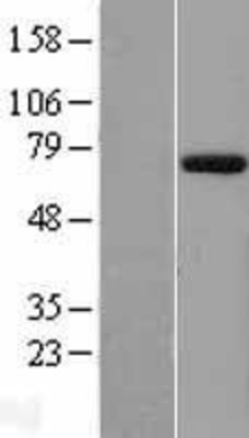 Western Blot: EYA1 Overexpression Lysate (Adult Normal) [NBP2-05187] Left-Empty vector transfected control cell lysate (HEK293 cell lysate); Right -Over-expression Lysate for EYA1.