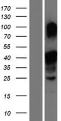 Western Blot: MLX Overexpression Lysate (Adult Normal) [NBP2-05216] Left-Empty vector transfected control cell lysate (HEK293 cell lysate); Right -Over-expression Lysate for MLX.