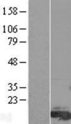 Western Blot: FAM81A Overexpression Lysate (Adult Normal) [NBP2-05352] Left-Empty vector transfected control cell lysate (HEK293 cell lysate); Right -Over-expression Lysate for FAM81A.
