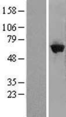 Western Blot: GBP5 Overexpression Lysate (Adult Normal) [NBP2-09550] Left-Empty vector transfected control cell lysate (HEK293 cell lysate); Right -Over-expression Lysate for GBP5.