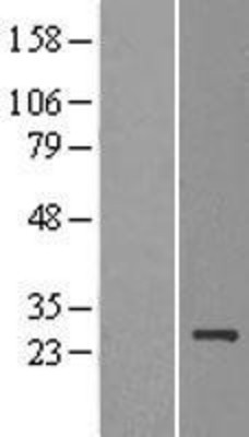 Western Blot: MDG1 Overexpression Lysate (Adult Normal) [NBL1-09943] Left-Empty vector transfected control cell lysate (HEK293 cell lysate); Right -Over-expression Lysate for MDG1.
