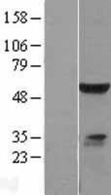 Western Blot: ELK4 Overexpression Lysate (Adult Normal) [NBL1-10234] Left-Empty vector transfected control cell lysate (HEK293 cell lysate); Right -Over-expression Lysate for ELK4.