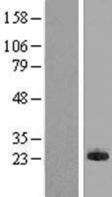 Western Blot: MPHOSPH6 Overexpression Lysate (Adult Normal) [NBL1-13198] Left-Empty vector transfected control cell lysate (HEK293 cell lysate); Right -Over-expression Lysate for MPHOSPH6.