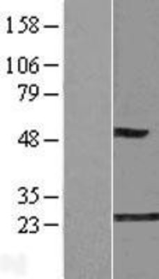 Western Blot: GLO1 Overexpression Lysate (Adult Normal) [NBL1-11117] Left-Empty vector transfected control cell lysate (HEK293 cell lysate); Right -Over-expression Lysate for GLO1.