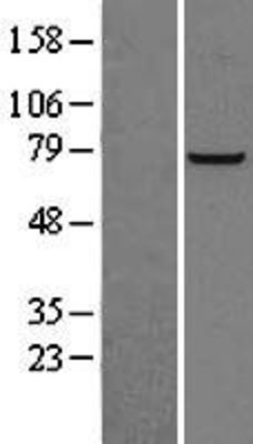 Western Blot: PFKL Overexpression Lysate (Adult Normal) [NBL1-14314] Left-Empty vector transfected control cell lysate (HEK293 cell lysate); Right -Over-expression Lysate for PFKL.
