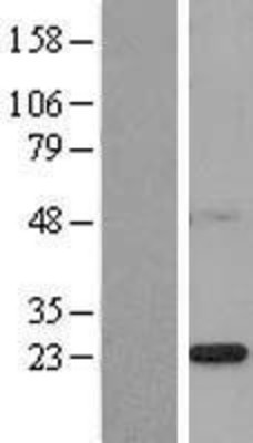 Western Blot: PSF2 Overexpression Lysate (Adult Normal) [NBL1-11077] Left-Empty vector transfected control cell lysate (HEK293 cell lysate); Right -Over-expression Lysate for PSF2.
