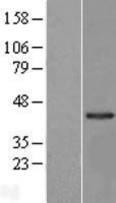 Western Blot: LRRC23 Overexpression Lysate (Adult Normal) [NBP2-09569] Left-Empty vector transfected control cell lysate (HEK293 cell lysate); Right -Over-expression Lysate for LRRC23.